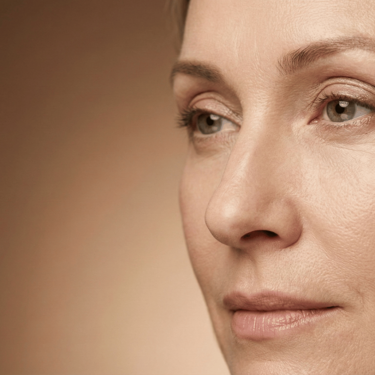 blepharoplasty_revision