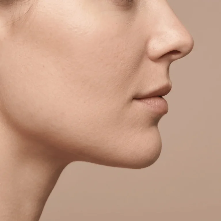 jawline-filler